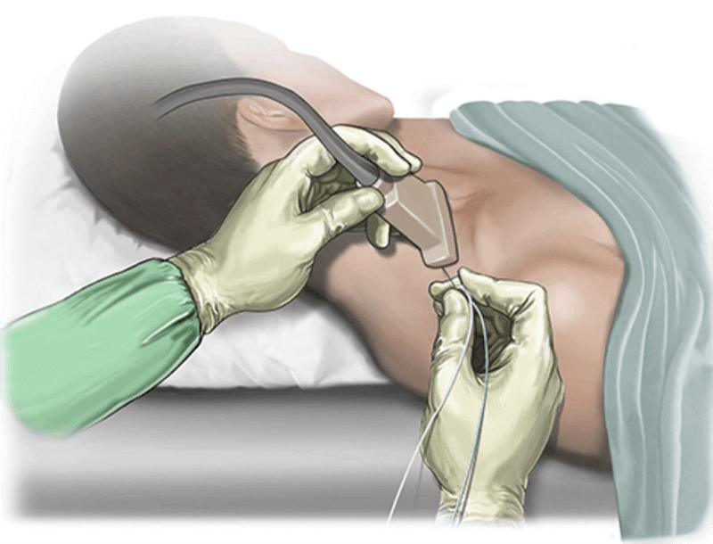 peripheral nerve block Peripheral Joint Injections Peripheral Joint Injections,Chiropractic Services in Hazlet,Pain Treatment,Joint Pain Relief NJ,Non-Surgical Pain Treatment NJ Airport Plaza Spine and Wellness