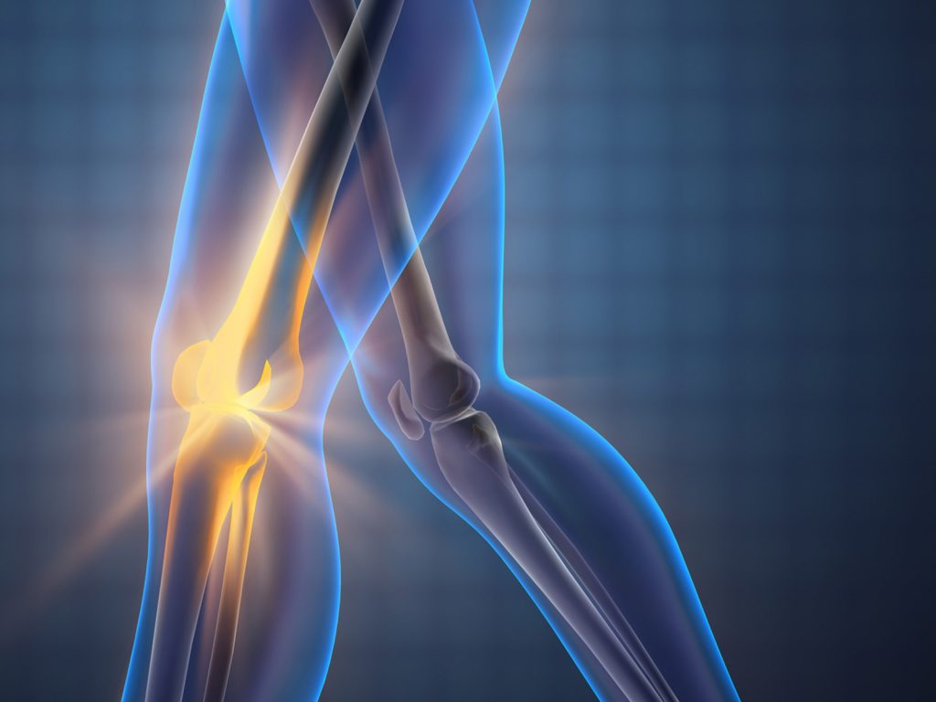 osteoarthritis 1600 Osteoarthritis Airport Plaza Spine and Wellness