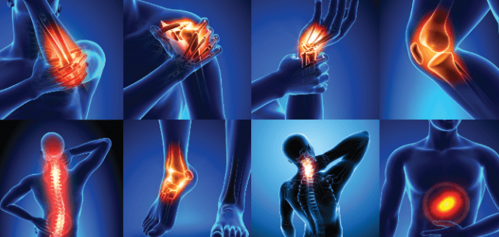 2022 10 13 Osteoarthritis Airport Plaza Spine and Wellness
