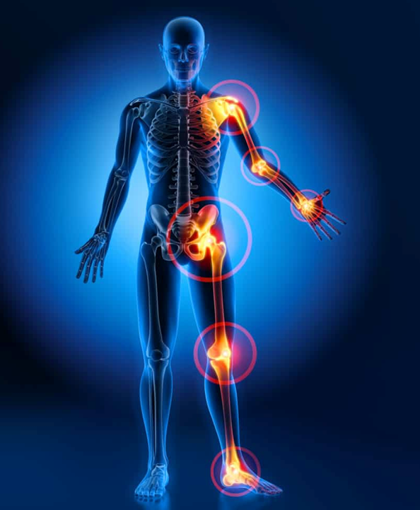 2022 10 28 Osteoarthritis Airport Plaza Spine and Wellness