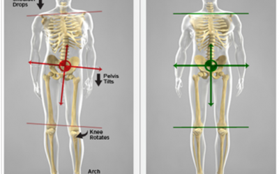 Could Your Pain be Caused by a Difference in Leg Length?