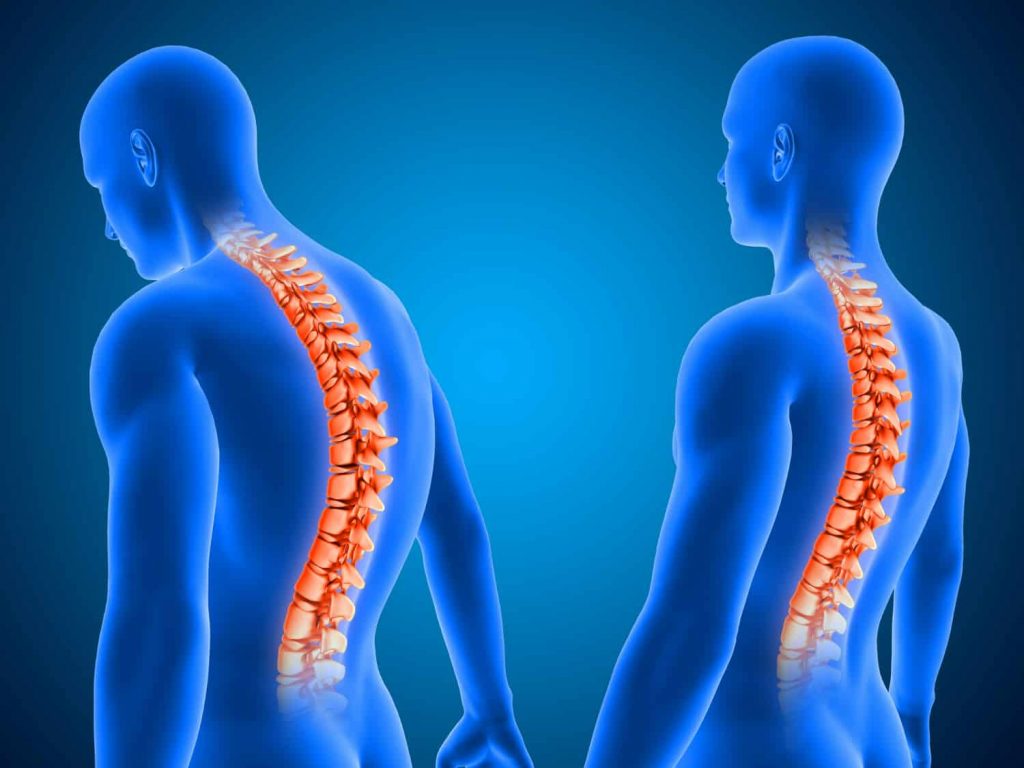 Posture and Spinal Health