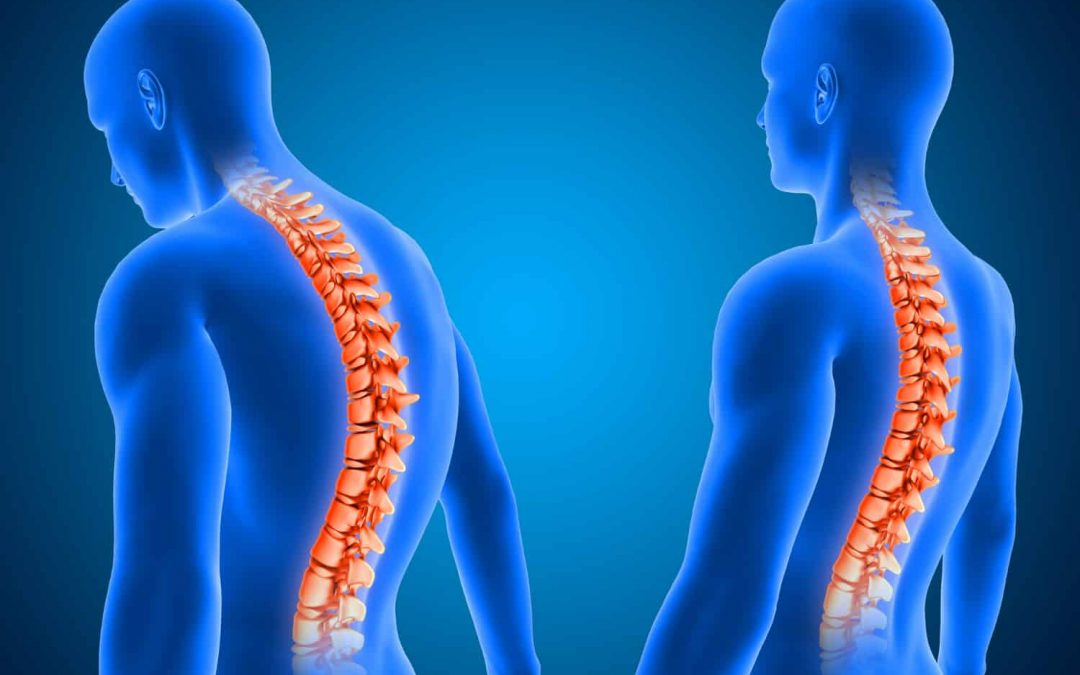 Posture and Spinal Health