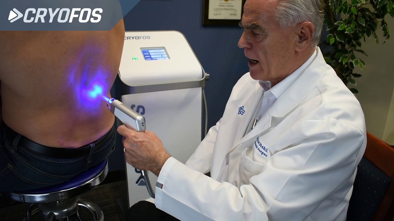 cryofos nrs therapy treatment of Cryotherapy in Hazlet Cryotherapy in Hazlet,Chiropractic Services in Hazlet,Cold therapy NJ,Pain relief Hazlet,Sports rehab Hazlet Airport Plaza Spine and Wellness