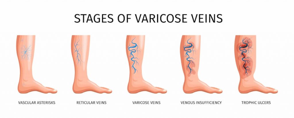 Improve Circulation Naturally