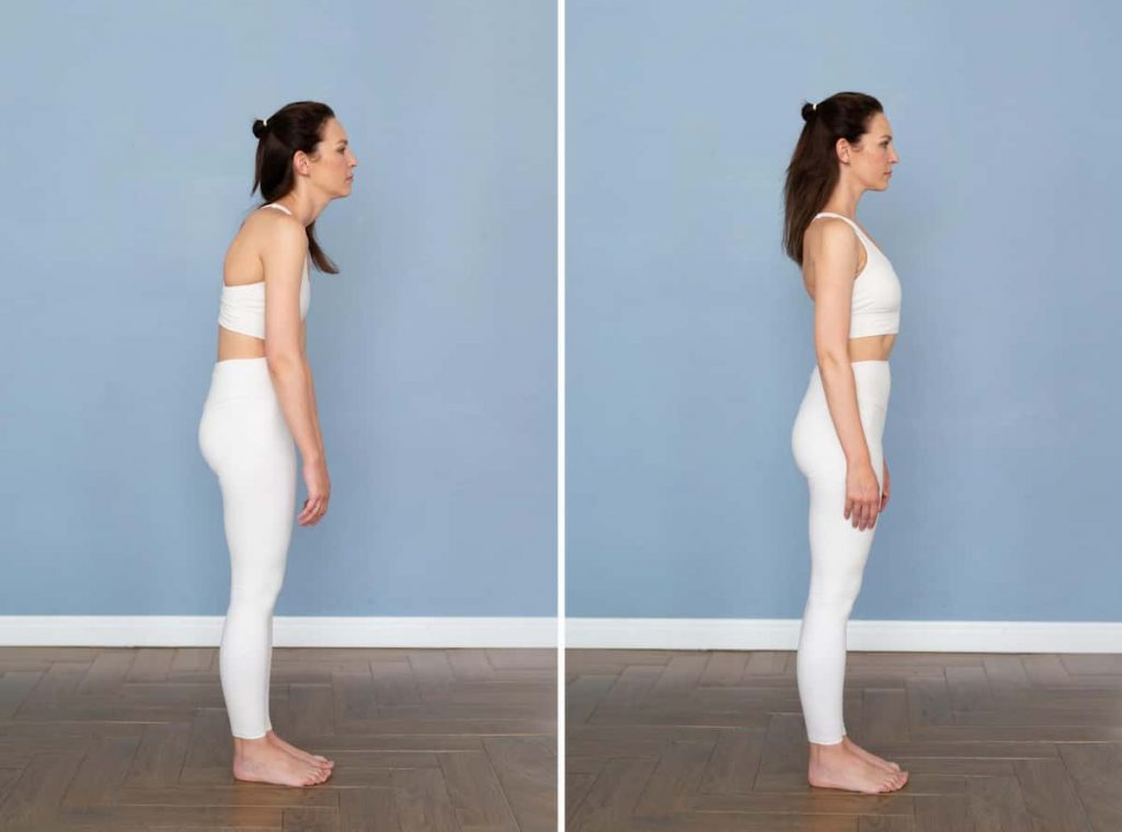 chiropractic posture correction