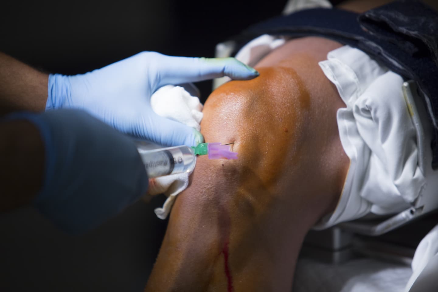 cropped hands doctor injecting syringe patient knee 1