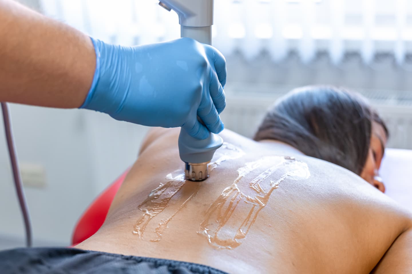 extracorporeal shockwave therapy physical therapy neck back muscles 1