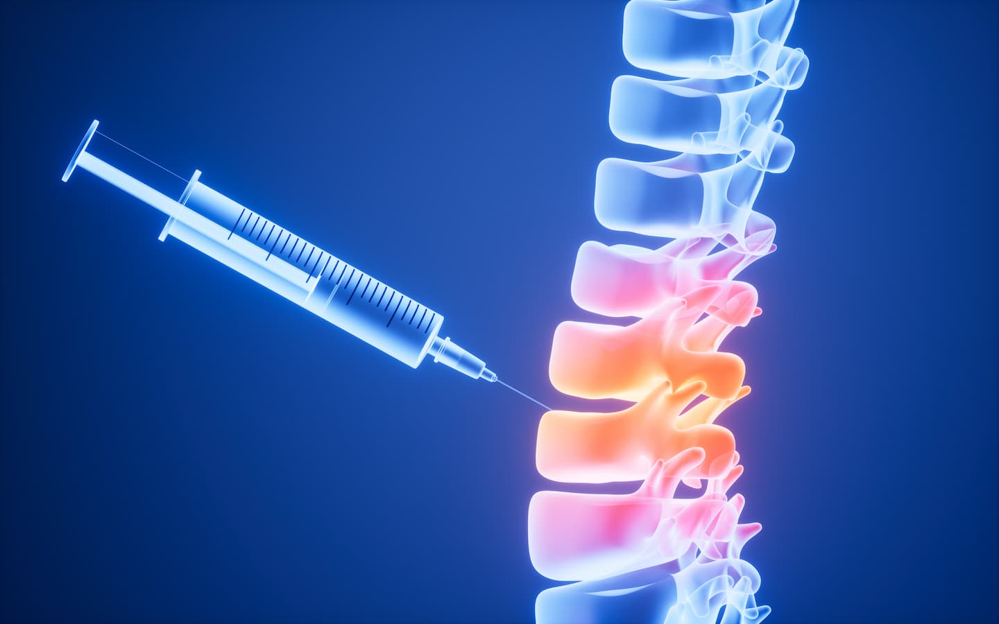 inflammation human spine drug therapy medical concept 3d rendering 1