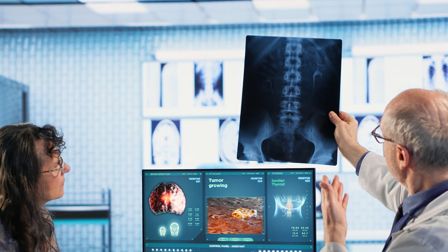 oncology consultation takes place as senior medic explains radiology scan 1