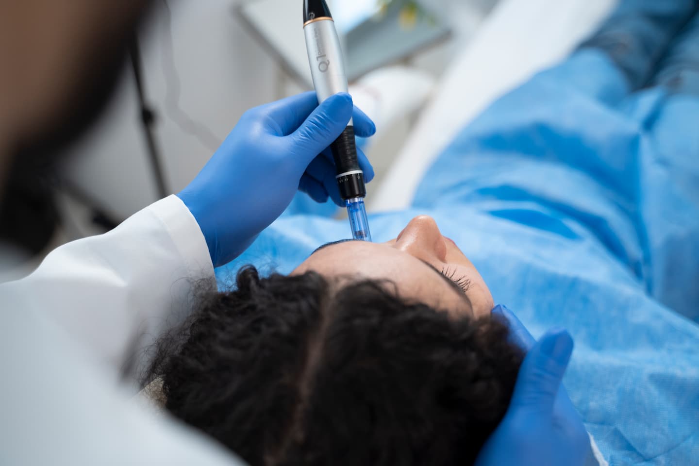 patient undergoing microneedling procedure 1