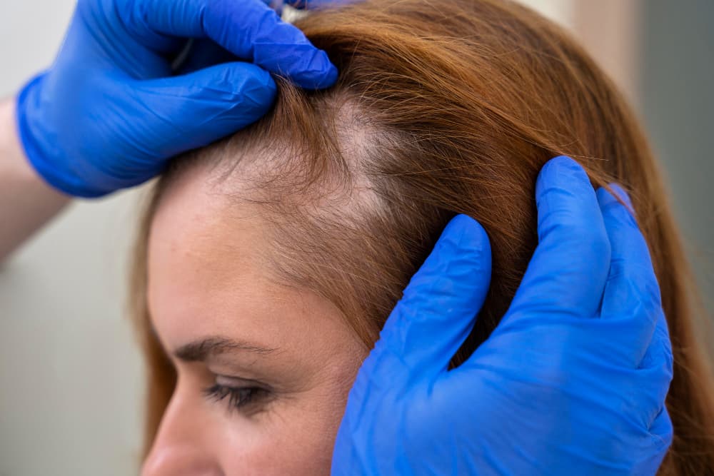 2149152754 PRP for Hair Loss PRP for Hair Loss,Headache Relief,Pain Relief,Non-surgical hair regrowth,Hair restoration treatment Airport Plaza Spine and Wellness