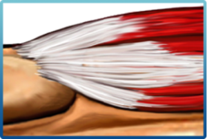 Picture1 1 300x201 1 HydroCision TenJet HydroCision TenJet,Chiropractic Services in Hazlet,tendinitis,Regenerative medicine NJ,TenJet procedure Hazlet Airport Plaza Spine and Wellness